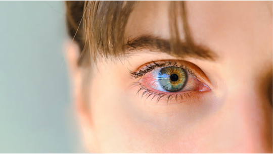 Osnove za njegu očiju: stručni savjeti o suplementima, hrani bogatoj nutrijentima i više od toga