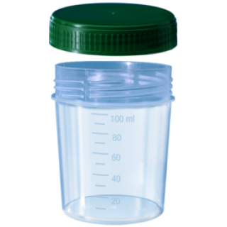 Sarstedt urine cup with screw cap