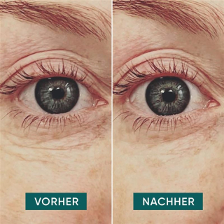 APRICOT wiederv Anti-Falt-Augen Pads Hyalur