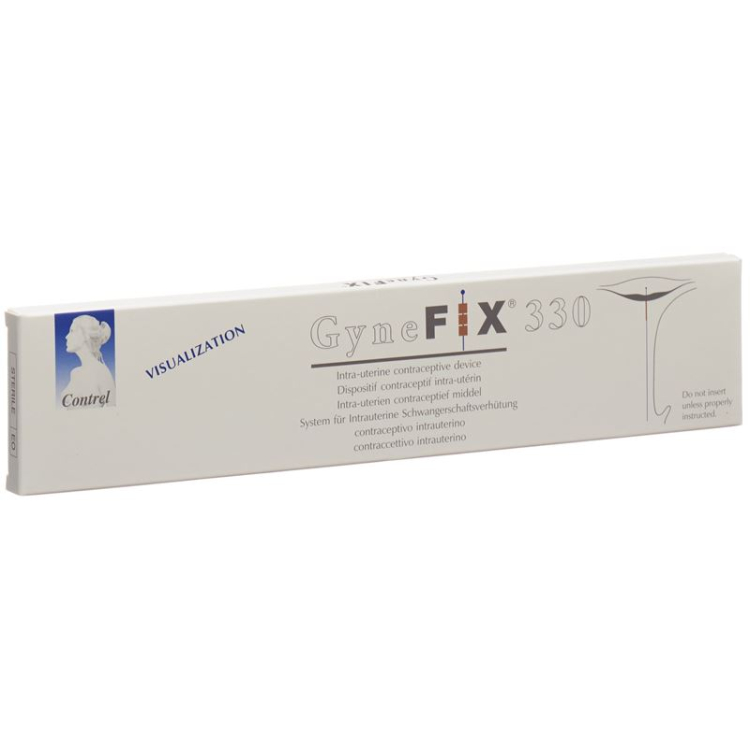 GyneFix 330 IUD